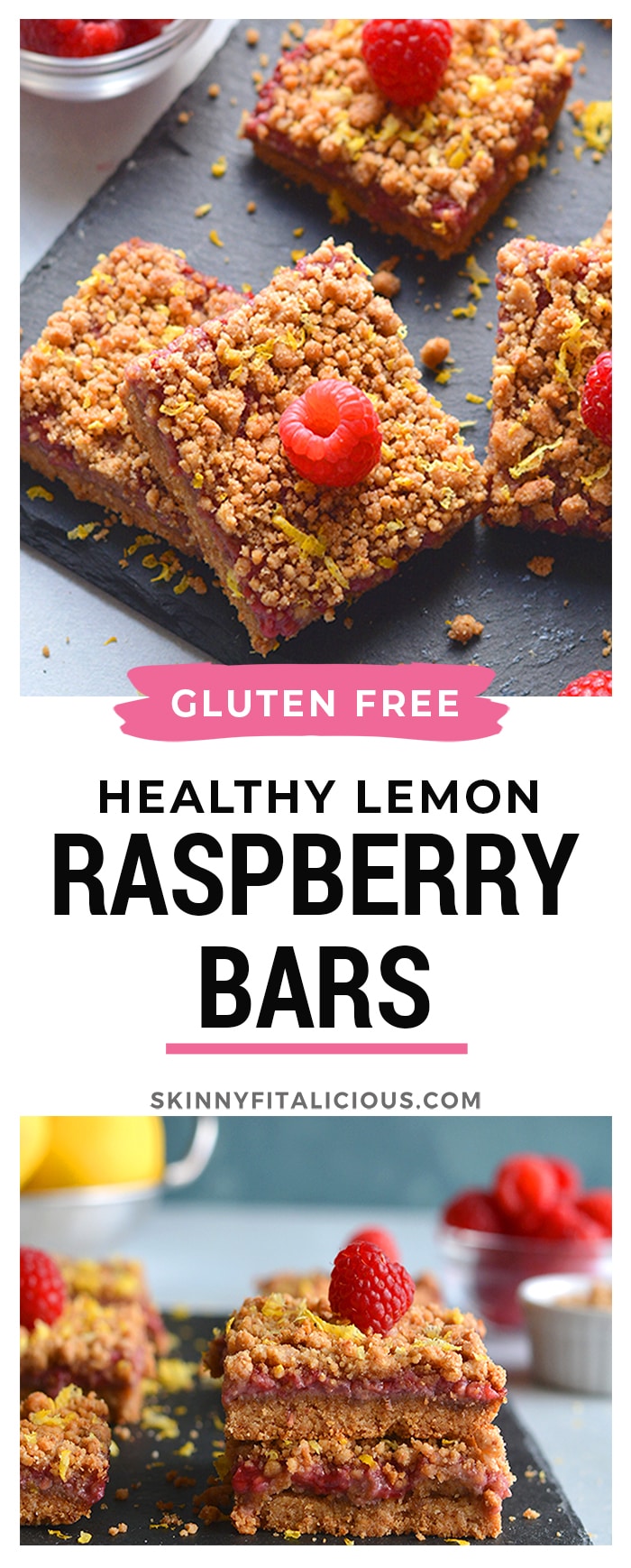 Raspberry Crumb Bars! Dairy-free, made with almond flour and wholesome ingredients! A truly addicting grain-free dessert that's good for you.